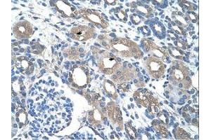 Image no. 1 for anti-Radical S-Adenosyl Methionine Domain Containing 2 (RSAD2) (C-Term) antibody (ABIN203447)
