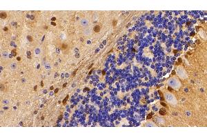Detection of S100B in Mouse Cerebellum Tissue using Polyclonal Antibody to S100 Calcium Binding Protein B (S100B) (S100B anticorps  (AA 1-92))