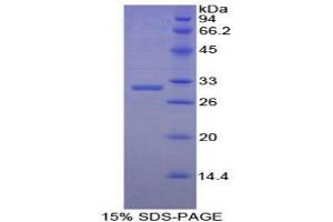 SDS-PAGE analysis of Human Early B-Cell Factor 2 Protein. (EBF2 Protéine)