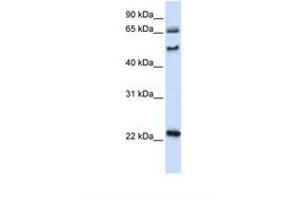 Image no. 1 for anti-UNC Homeobox (UNCX) (AA 74-123) antibody (ABIN6739205) (UNCX anticorps  (AA 74-123))