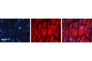 Rabbit Anti-PDHB Antibody   Formalin Fixed Paraffin Embedded Tissue: Human heart Tissue Observed Staining: Cytoplasmic Primary Antibody Concentration: 1:100 Other Working Concentrations: 1:600 Secondary Antibody: Donkey anti-Rabbit-Cy3 Secondary Antibody Concentration: 1:200 Magnification: 20X Exposure Time: 0.