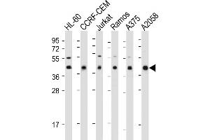 All lanes : Anti-HLA-B Antibody (N-term) at 1:1000-2000 dilution Lane 1: HL-60 whole cell lysate Lane 2: CCRF-CEM whole cell lysate Lane 3: Jurkat whole cell lysate Lane 4: Ramos whole cell lysate Lane 5:  whole cell lysate Lane 6:  whole cell lysate Lysates/proteins at 20 μg per lane.