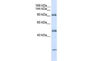 WB Suggested Anti-AARS Antibody Titration:  0.