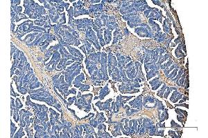 IHC analysis of Serum Amyloid P/APCS using anti-Serum Amyloid P/APCS antibody (ABIN5693182).