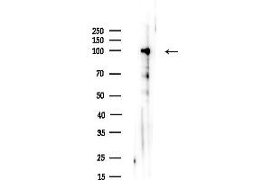 anti-Transforming, Acidic Coiled-Coil Containing Protein 1 (TACC1) (N-Term) antibody