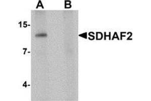 Western blot analysis of SDHAF2 in rat liver tissue lysate with SDHAF2 antibody at 1 ug/mL in (A) the absence and (B) the presence of blocking peptide. (Sdhaf2 anticorps  (N-Term))