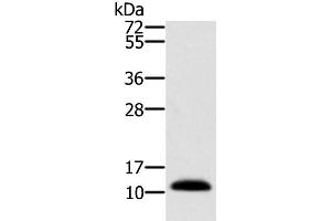 Western Blot analysis of Human prostate tissue using MSMB Polyclonal Antibody at dilution of 1:250 (MSMB anticorps)