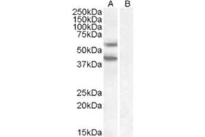 Image no. 1 for anti-Diacylglycerol O-Acyltransferase 2 (DGAT2) (C-Term), (Internal Region) antibody (ABIN374843) (DGAT2 anticorps  (C-Term, Internal Region))