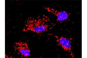 Proximity Ligation Analysis of protein-protein interactions between TRAF2 and MAPK9.