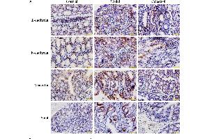 Effects of celastrol (2 mg/kg) on the expression levels of EMT-related proteins in AOM/DSS-treated mice. (SNAI1, SNAI2, SNAI3 (AA 188-264) anticorps)