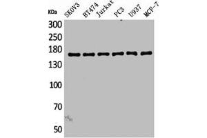 Western Blot analysis of SKOV3 BT474 Jurkat PC-3 U937 MCF7 cells using SCP-2 Polyclonal Antibody (SYCP2 anticorps  (Internal Region))
