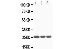 Anti-SOCS3 antibody, Western blotting Lane 1: JURKAT Cell Lysate Lane 2: CEM Cell Lysate Lane 3: RAJI Cell Lysate (SOCS3 anticorps  (Middle Region))