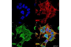 Immunocytochemistry/Immunofluorescence analysis using Mouse Anti-ASIC1 Monoclonal Antibody, Clone S271-44 . (ASIC1 anticorps  (AA 460-526))