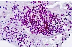 Human Spleen: Formalin-Fixed, Paraffin-Embedded (FFPE)