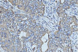 IHC analysis of Cytokeratin 5 using anti-Cytokeratin 5 antibody (ABIN7602992). (Cytokeratin 5 anticorps  (Middle Region))
