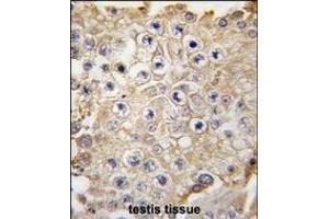 Formalin-fixed and paraffin-embedded human testis tissue reacted with PBP1 antibody (C-term) 7237e , which was peroxidase-conjugated to the secondary antibody, followed by DAB staining. (NAE1 anticorps  (C-Term))