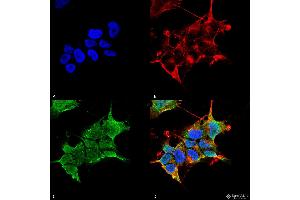 Immunocytochemistry/Immunofluorescence analysis using Mouse Anti-GABA-A Receptor Alpha4 Monoclonal Antibody, Clone S398A-34 . (GABRA1 anticorps  (AA 410-450) (FITC))