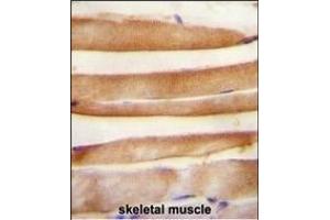 ARV1 antibody (N-term) (ABIN654612 and ABIN2844312) immunohistochemistry analysis in formalin fixed and paraffin embedded human skeletal muscle followed by peroxidase conjugation of the secondary antibody and DAB staining.