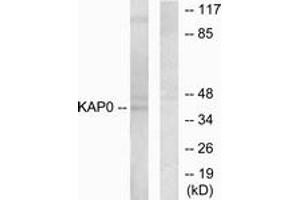 Western blot analysis of extracts from HepG2 cells, using KAP0 Antibody. (PRKAR1A anticorps  (AA 271-320))