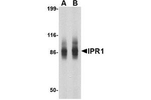 Western blot analysis of IPR1 in SW480 cell lysate with IPR1 antibody at (A) 1 and (B) 2 μg/ml. (SP110 anticorps  (N-Term))