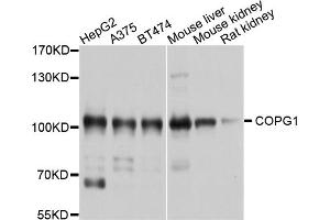 Western blot analysis of extracts of various cell lines, using COPG1 antibody (ABIN4903348) at 1:1000 dilution. (COPG anticorps)