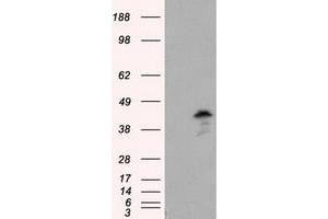 Western Blotting (WB) image for anti-Induced Myeloid Leukemia Cell Differentiation Protein Mcl-1 (MCL1) antibody (ABIN1499337) (MCL-1 anticorps)