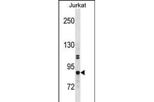 CHUK Antibody (N-term) (ABIN1881203 and ABIN2838746) western blot analysis in Jurkat cell line lysates (35 μg/lane). (IKK alpha anticorps  (N-Term))