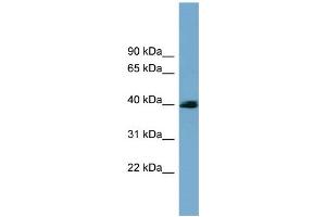 WB Suggested Anti-CXorf9 Antibody Titration: 0. (SASH3 anticorps  (N-Term))