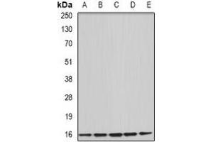 Western blot analysis of Uev1A expression in HepG2 (A), Hela (B), mouse brain (C), rat liver (D), rat spleen (E) whole cell lysates. (UBE2V1 anticorps)