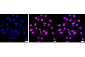 Immunocytochemical staining of HepG2 cells with PRPF4 antibody (ABIN7800056), 1:1,000).
