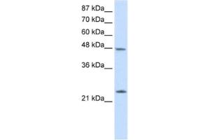 Western Blotting (WB) image for anti-Chromobox Homolog 6 (CBX6) antibody (ABIN2461846) (CBX6 anticorps)