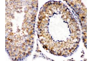 IHC testing of FFPE mouse testis with Smac antibody.