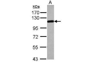 WB Image Sample (30 ug of whole cell lysate) A: Jurakt 7. (alpha Adducin anticorps)