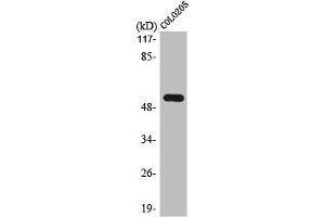 Western Blot analysis of COLO205 cells using LPD lipase Polyclonal Antibody (Lipase I anticorps  (Internal Region))