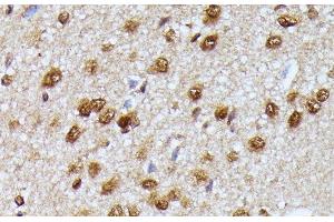 Immunohistochemistry of paraffin-embedded Rat brain using KIAA1429 Polyclonal Antibody at dilution of 1:100 (40x lens). (VIRMA/KIAA1429 anticorps)