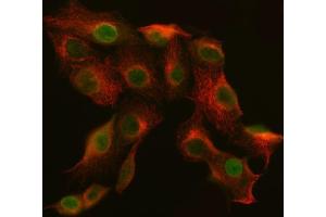 IF analysis of SNF2H/SMARCA5 and Tubulin beta using anti-SNF2H/SMARCA5 antibody (ABIN7600125) and anti-Tubulin beta antibody (ABIN7602744).