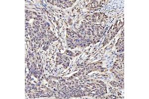 IHC analysis of SAP130 using anti-SAP130 antibody (ABIN7601247). (SAP130 anticorps  (AA 309-913))