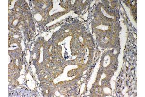 IHC analysis of MAVS using anti-MAVS antibody .
