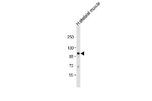 Anti-GAS2L2 Antibody (C-term) at 1:1000 dilution + human skeletal muscle lysate Lysates/proteins at 20 μg per lane. (GAS2L2 anticorps  (C-Term))
