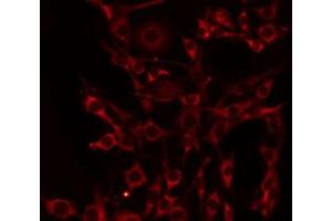 ABIN6275100 staining HeLa by IF/ICC. (CD39 anticorps  (Internal Region))