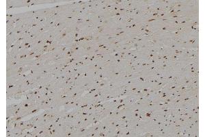 ABIN6274840 at 1/100 staining Rat heart tissue by IHC-P.