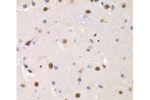 Immunohistochemistry of paraffin-embedded Rat brain using IRF2 Polyclonal Antibody at dilution of 1:200 (40x lens). (IRF2 anticorps)