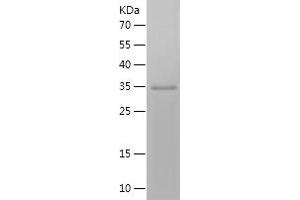 Western Blotting (WB) image for Interleukin 4 (IL4) (AA 25-153) protein (His-IF2DI Tag) (ABIN7123597) (IL-4 Protein (AA 25-153) (His-IF2DI Tag))
