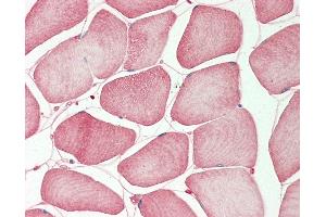 Human Skeletal Muscle: Formalin-Fixed, Paraffin-Embedded (FFPE). (TMPRSS3 anticorps  (N-Term))