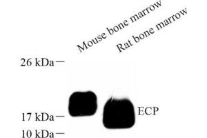 Western blot analysis of ECP (ABIN7073838) at dilution of 1: 1000 (RNASE3 anticorps)