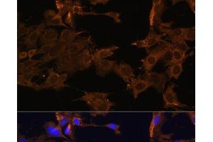 Immunofluorescence analysis of C6 cells using PDGFR beta Polyclonal Antibody at dilution of 1:100. (PDGFRB anticorps)
