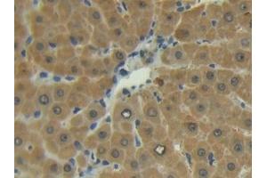 Detection of MMP13 in Human Liver Tissue using Polyclonal Antibody to Matrix Metalloproteinase 13 (MMP13)