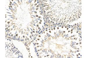 ABIN6257905 and ABIN6274686 at 1/100 staining Rat testis tissue by IHC-P.