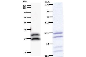 Left: C14orf172 staining. (TRMT61A anticorps)