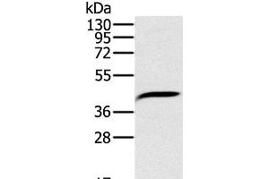 Western Blot analysis of Hela cell using PDSS2 Polyclonal Antibody at dilution of 1:200 (PDSS2 anticorps)